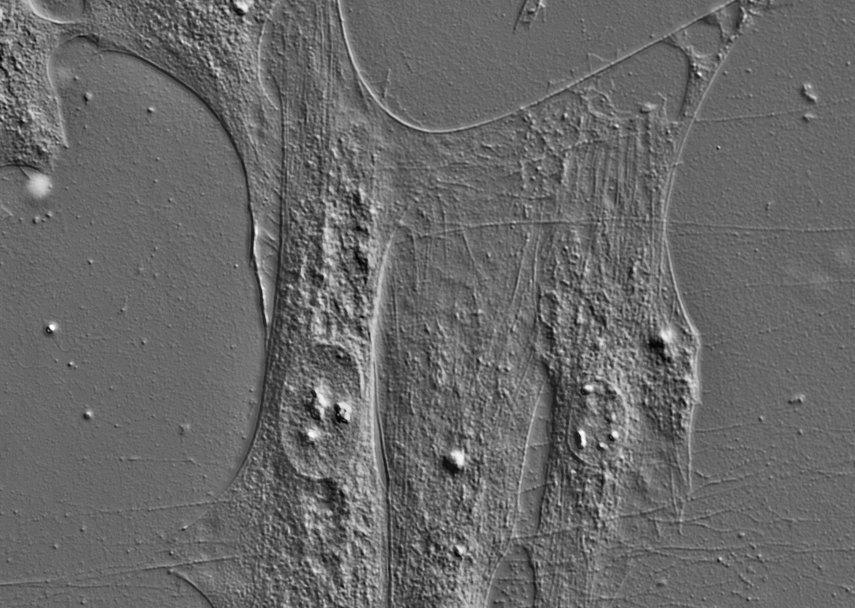 Differential Interference (DIC) microscopy | Advanced Optical Imaging Group